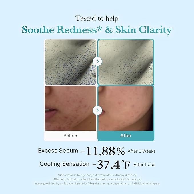 Medicube Azelaic Acid Clarifying Toner – tónico coreano – imagen 3
