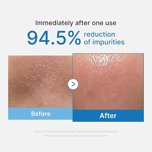 Medicube Zero Pore Blackhead Deep Cleansing Oil 205 ml – limpiador facial coreano – imagen 5