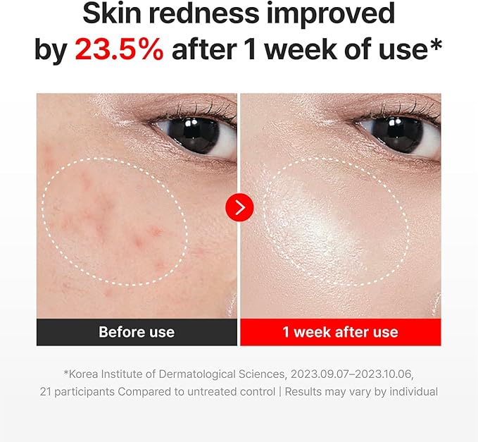 CENTELLIAN 24 Madeca Time Reverse Cream | Crema Antiedad con Complejo TECA Patentado, Retinol, Resveratrol, PDRN (ADN de Salmón), Ceramida NP y Ácido Hialurónico | 10 Beneficios Antiedad en Una Crema | Fórmula K-Beauty Farmacéutica | 50 ml