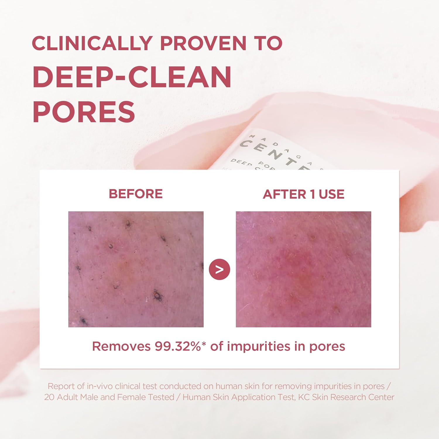 SKIN1004 Madagascar Centella Poremizing Deep Cleansing Foam 125 ml | Limpiadora facial espumosa con centella y sal rosa del Himalaya para poros y exceso de sebo