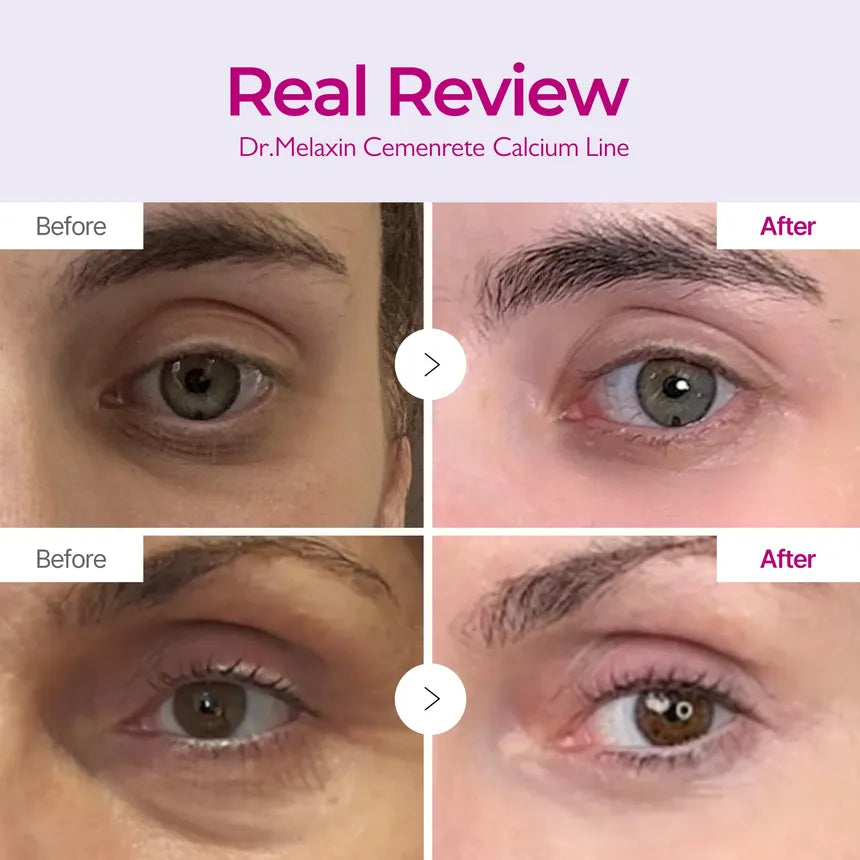Dr. Melaxin Cemenrete Calcium Volume Cream | Crema Antiedad con REBORNIC · Calcio Ionizado 10.000 PPM + Ácido Hialurónico Triple + Colágeno + Elastina + Manteca de Karité + Aceite de Macadamia | Firmeza · Volumen · Elasticidad