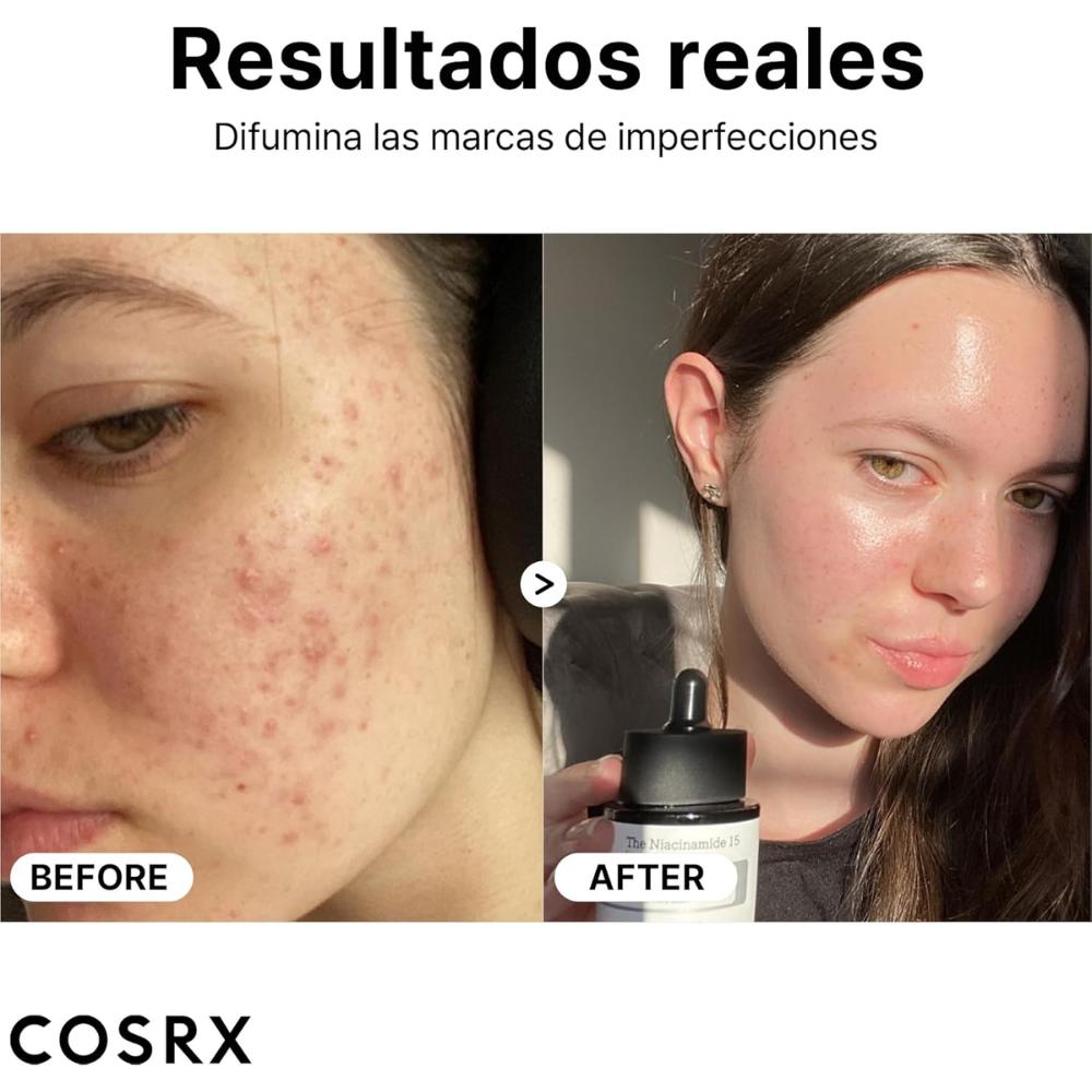 COSRX The Niacinamide 15 Serum 20 ml, sérum facial ultraligero de rápida absorción con Niacinamide 15% + Zinc PCA 1% + Acetyl Glucosamine (NAG)