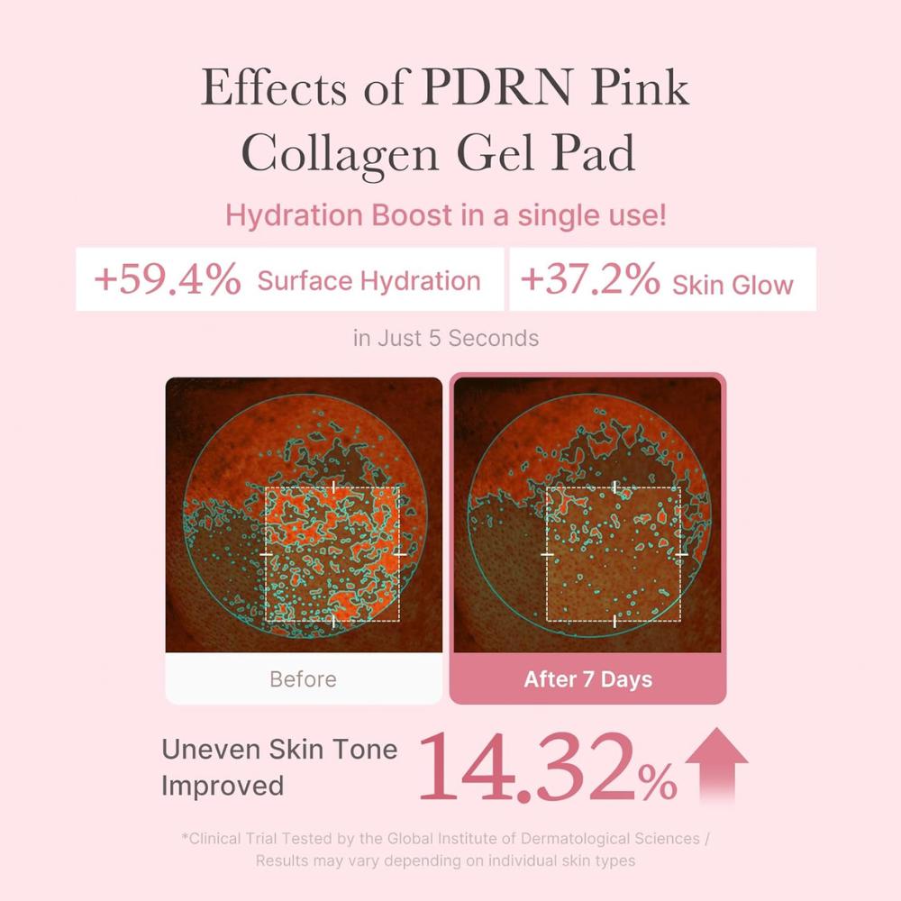 medicube PDRN Pink Collagen Toning Gel Toner Pad 70 pads | PDRN (Sodium DNA) + Colágeno + Niacinamida + Centella + Madecassoside + Retinol + LHA